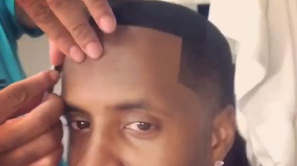 Safaree Shows Fake Hairline Up Close and Says You Can Get One Too