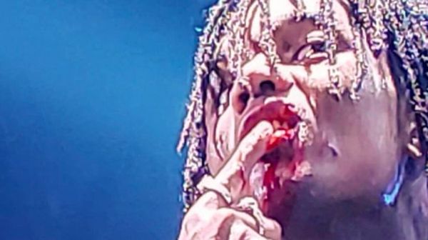 Watch Swae Lee Yell At Fan For Busting Up His Mouth
