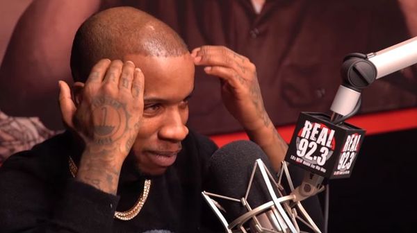 Tory Lanez Admits To Having A Fake Hairline