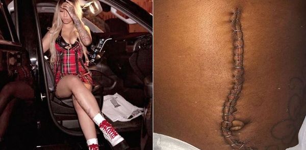 Cuban Doll Dropped From Label After Chain Snatching & Slashing Incident