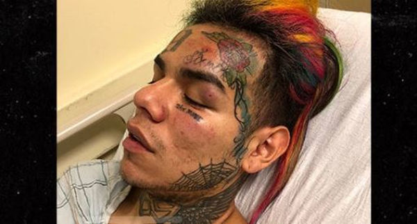 The Guy Who Pistol Whipped & Robbed Tekashi 6ix9ine Used To Be Part Of His Crew