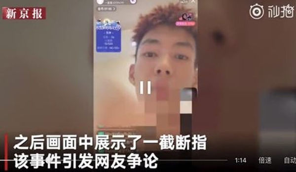 Chinese Rapper Cuts Off Finger During Livestream To Prove He Wasn't Banging Fans