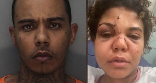 Yung Berg Accused Of Pistol-Whipping Girlfriend